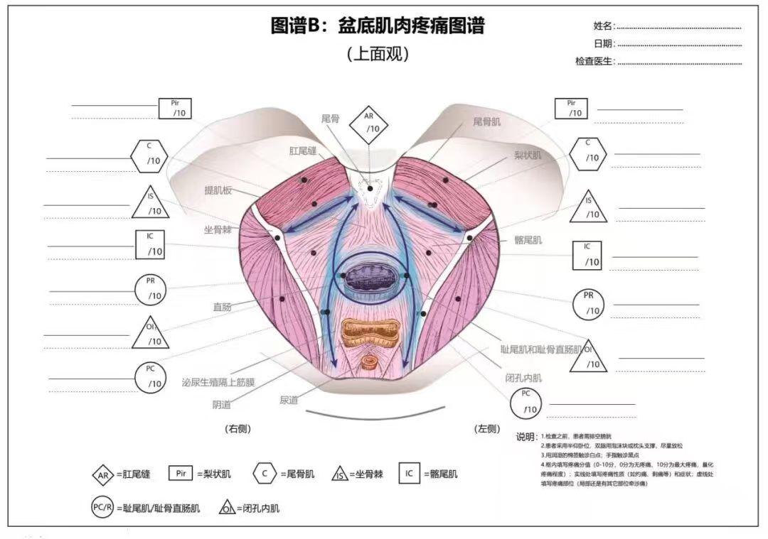 神秘的盆底扳机点：藏在身体里的疼痛开关